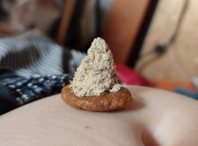 Self-care Moxa – Edinburgh